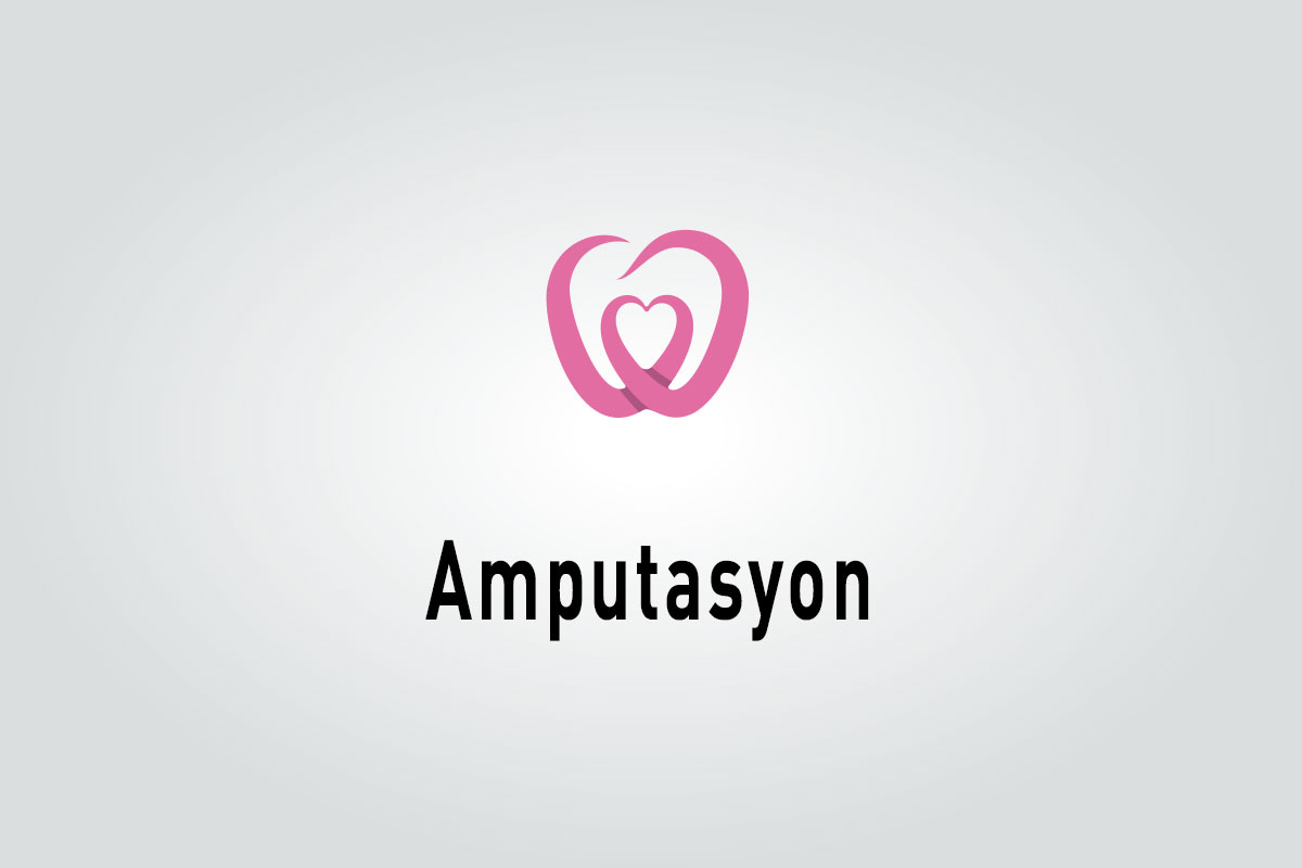 Amputasyon